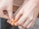 Begyulladt köröm eltávolítása sebészeti úton