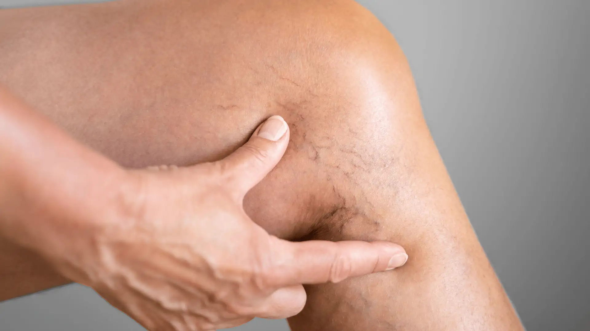 ergyulladas Érgyulladás